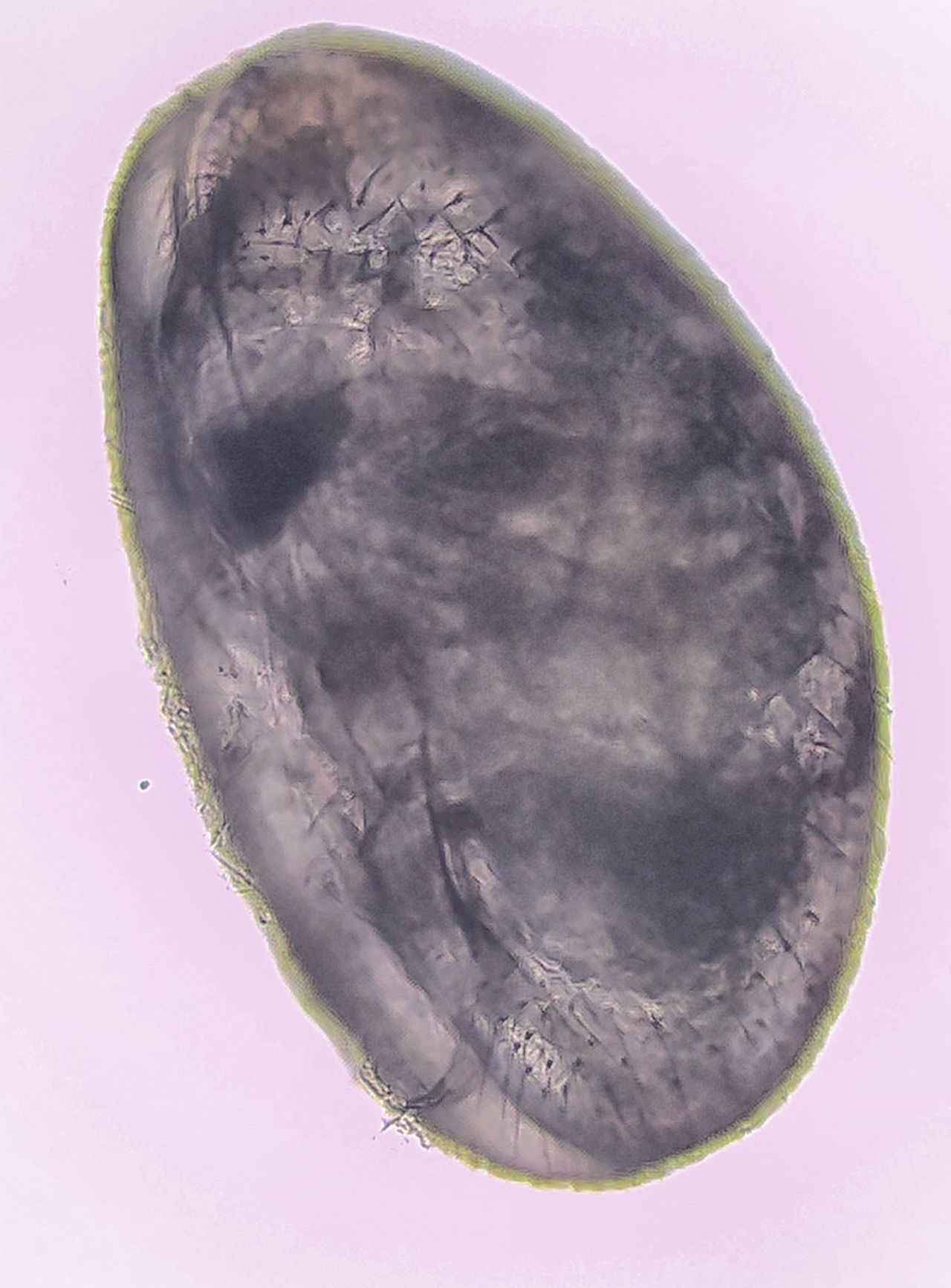 I signori del fango: gli Ostracodi